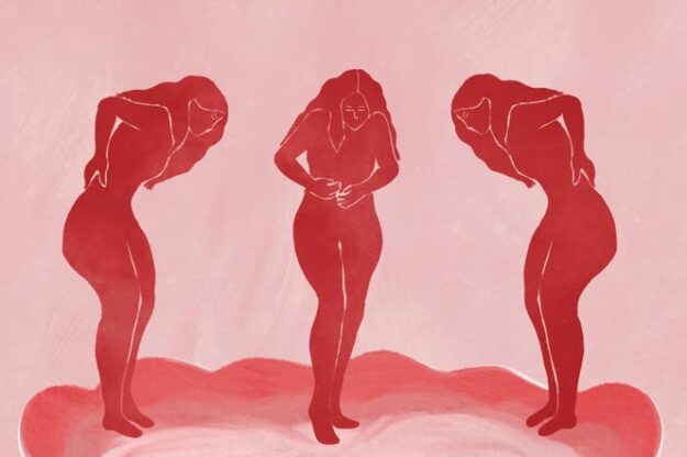 endometriosis y acupuntura endometriosis